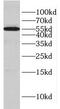 Glycerate Kinase antibody, FNab03510, FineTest, Western Blot image 