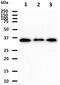 Potassium Channel Tetramerization Domain Containing 15 antibody, GTX57561, GeneTex, Western Blot image 