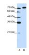 A-Kinase Anchoring Protein 8 Like antibody, orb330038, Biorbyt, Western Blot image 