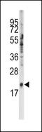 Small Nuclear Ribonucleoprotein Polypeptide C antibody, MBS9215002, MyBioSource, Western Blot image 