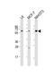 YES Proto-Oncogene 1, Src Family Tyrosine Kinase antibody, PA5-72259, Invitrogen Antibodies, Western Blot image 