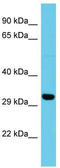 Distal Membrane Arm Assembly Complex 2 antibody, TA330666, Origene, Western Blot image 