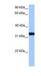 Lactate Dehydrogenase C antibody, NBP1-54798, Novus Biologicals, Western Blot image 