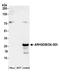 Rho GDP Dissociation Inhibitor Beta antibody, A304-815A, Bethyl Labs, Western Blot image 
