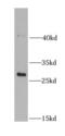 NADH:Ubiquinone Oxidoreductase Core Subunit S3 antibody, FNab05630, FineTest, Western Blot image 