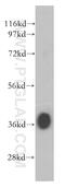 DNA Meiotic Recombinase 1 antibody, 13714-1-AP, Proteintech Group, Western Blot image 