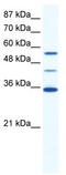 ALX Homeobox 4 antibody, TA341710, Origene, Western Blot image 