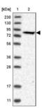 Phosphofructokinase, Liver Type antibody, NBP1-85934, Novus Biologicals, Western Blot image 