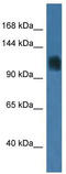 Recombination Activating 1 antibody, TA329558, Origene, Western Blot image 