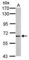 MLPH antibody, PA5-28733, Invitrogen Antibodies, Western Blot image 