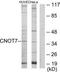 CCR4-NOT Transcription Complex Subunit 7 antibody, TA315399, Origene, Western Blot image 