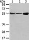 UDP Glucuronosyltransferase Family 1 Member A10 antibody, PA5-51151, Invitrogen Antibodies, Western Blot image 