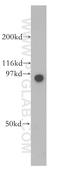 Glucosamine (N-Acetyl)-6-Sulfatase antibody, 13044-1-AP, Proteintech Group, Western Blot image 