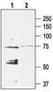 Potassium Voltage-Gated Channel Subfamily J Member 5 antibody, TA328939, Origene, Western Blot image 