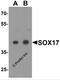 SRY-Box 17 antibody, 7917, ProSci, Western Blot image 