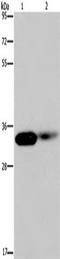 LIM Zinc Finger Domain Containing 1 antibody, TA350137, Origene, Western Blot image 