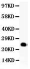 Glial Cell Derived Neurotrophic Factor antibody, PB9069, Boster Biological Technology, Western Blot image 