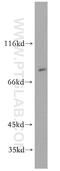 Bardet-Biedl Syndrome 2 antibody, 11188-2-AP, Proteintech Group, Western Blot image 