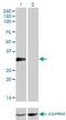 Cone-Rod Homeobox antibody, H00001406-M01, Novus Biologicals, Western Blot image 