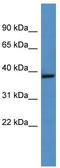 Growth Hormone Inducible Transmembrane Protein antibody, TA341936, Origene, Western Blot image 