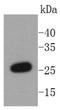 NRH:quinone oxidoreductase 2 antibody, NBP2-67638, Novus Biologicals, Western Blot image 