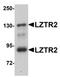 Protein transport protein Sec16B antibody, orb75368, Biorbyt, Western Blot image 
