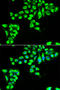 CLDN2 antibody, STJ28643, St John