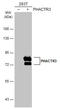 Phosphatase And Actin Regulator 3 antibody, GTX119979, GeneTex, Western Blot image 