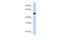 Chromosome 9 Open Reading Frame 43 antibody, 27-046, ProSci, Western Blot image 