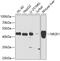 Nuclear Receptor Subfamily 2 Group E Member 1 antibody, 22-952, ProSci, Western Blot image 