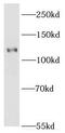 EPH Receptor A8 antibody, FNab02806, FineTest, Western Blot image 
