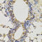 CD45 antibody, LS-B15351, Lifespan Biosciences, Immunohistochemistry paraffin image 