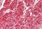 Arginyltransferase 1 antibody, ARP48723_P050, Aviva Systems Biology, Immunohistochemistry paraffin image 
