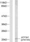 p21 antibody, LS-C117437, Lifespan Biosciences, Western Blot image 