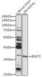 Branched Chain Amino Acid Transaminase 2 antibody, GTX33036, GeneTex, Western Blot image 