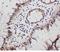 Progesterone Receptor antibody, PA1413, Boster Biological Technology, Immunohistochemistry frozen image 