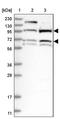 B Cell Scaffold Protein With Ankyrin Repeats 1 antibody, PA5-57910, Invitrogen Antibodies, Western Blot image 