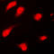 PTTG1 Regulator Of Sister Chromatid Separation, Securin antibody, LS-C353139, Lifespan Biosciences, Immunofluorescence image 