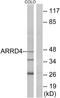 Arrestin Domain Containing 4 antibody, PA5-38852, Invitrogen Antibodies, Western Blot image 