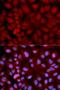 SNCG antibody, LS-B14232, Lifespan Biosciences, Immunofluorescence image 