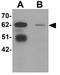 Leucine-rich repeat transmembrane neuronal protein 3 antibody, GTX32003, GeneTex, Western Blot image 