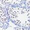 Histone Cluster 3 H3 antibody, GTX54139, GeneTex, Immunohistochemistry paraffin image 
