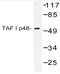 SET Nuclear Proto-Oncogene antibody, AP20445PU-N, Origene, Western Blot image 