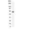 Hnf-1b antibody, R31391, NSJ Bioreagents, Western Blot image 