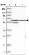 Spermatogenesis Associated 18 antibody, NBP1-81984, Novus Biologicals, Western Blot image 