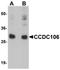 Coiled-Coil Domain Containing 106 antibody, orb94564, Biorbyt, Western Blot image 