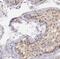 MAP3K12 Binding Inhibitory Protein 1 antibody, FNab05038, FineTest, Immunohistochemistry paraffin image 