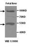 ADAM Metallopeptidase With Thrombospondin Type 1 Motif 8 antibody, orb76987, Biorbyt, Western Blot image 