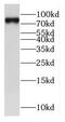 E2F Transcription Factor 8 antibody, FNab02604, FineTest, Western Blot image 