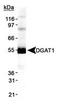 Diacylglycerol O-acyltransferase 1 antibody, PA1-16985, Invitrogen Antibodies, Western Blot image 